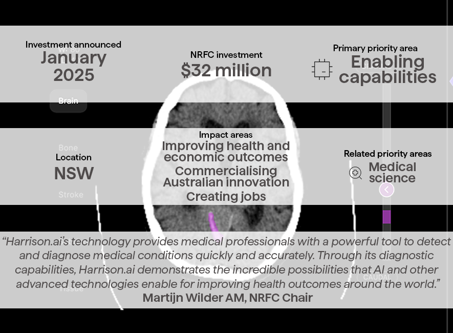 A graphic of the details of the NRFC's investment in Harrison.ai.