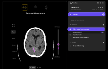 An image of a medical scan.
