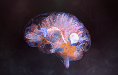 A graphic of a brain illustrating brain mapping technology.
